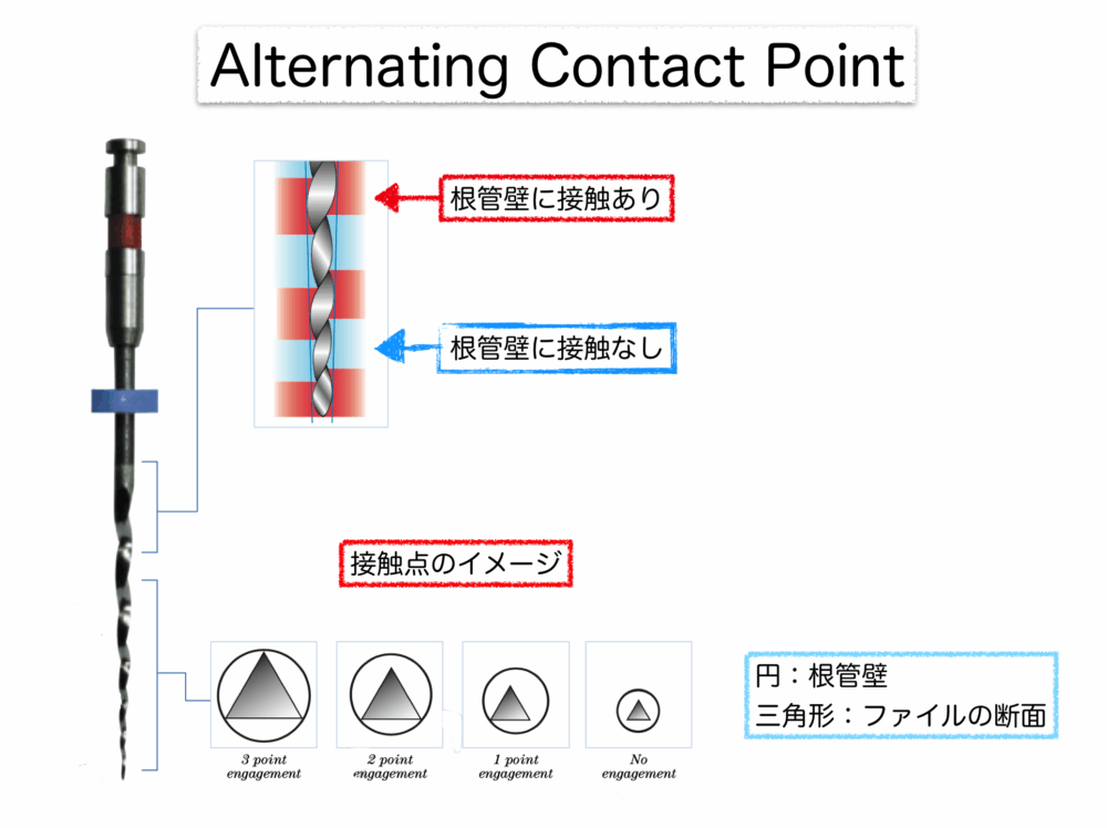 NiTiファイルのデザインについて