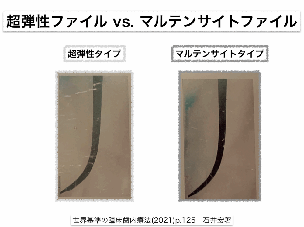 NiTiファイルの進化について〜材質の改良：マルテンサイト相について〜